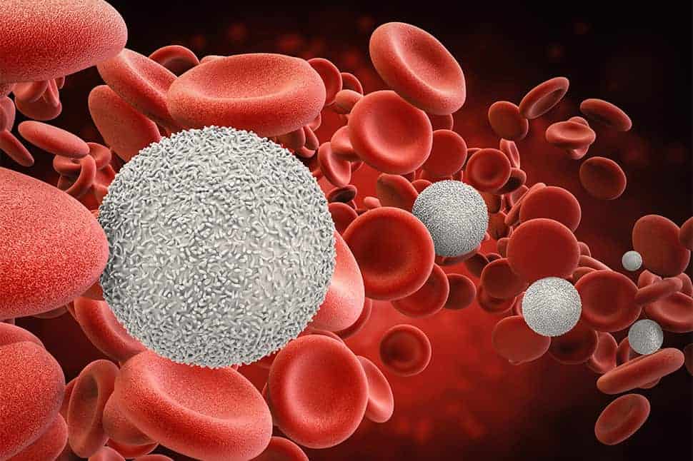 Blood Cancer Treatment Doctor in Lucknow