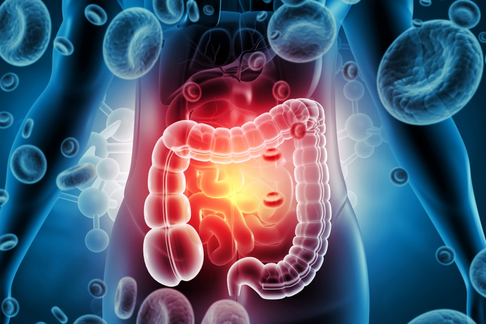 Colorectal Cancer Treatment in Lucknow