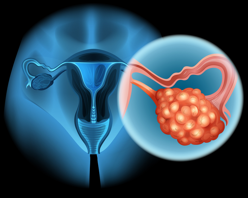 Gynecologic Cancer Specialist in Lucknow