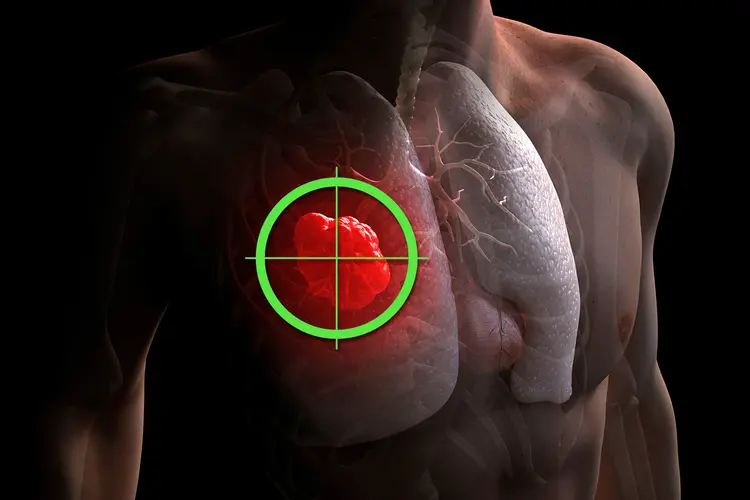 Targeted Therapy for Cancer in Lucknow